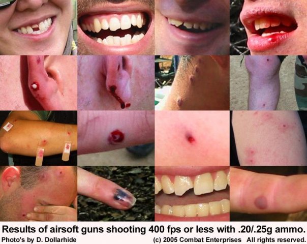 Травмы в страйкболе